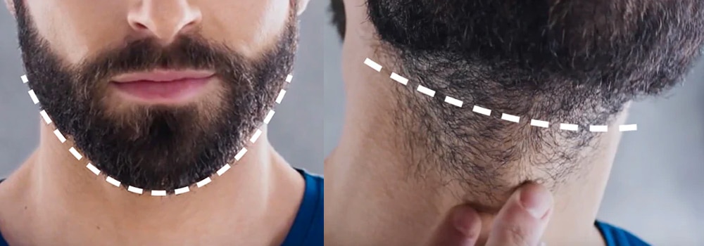 1 mm trimmed beard